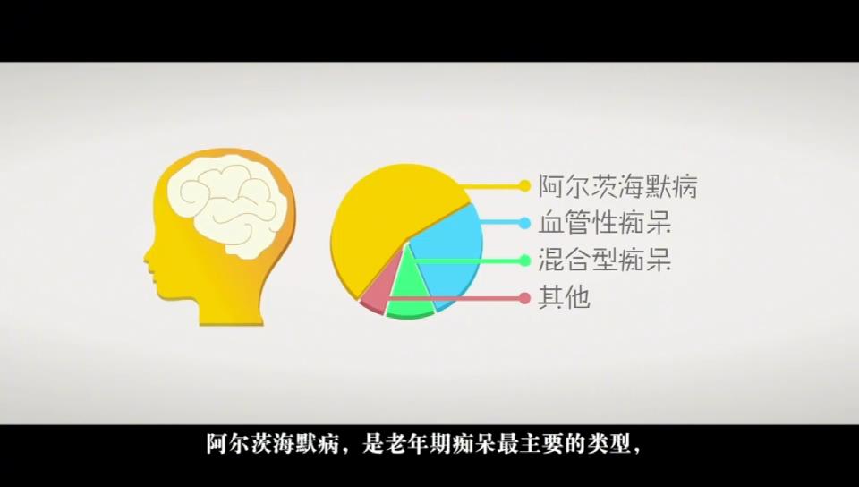 科普视频《阿尔茨海默病预防与干预核心信息》
